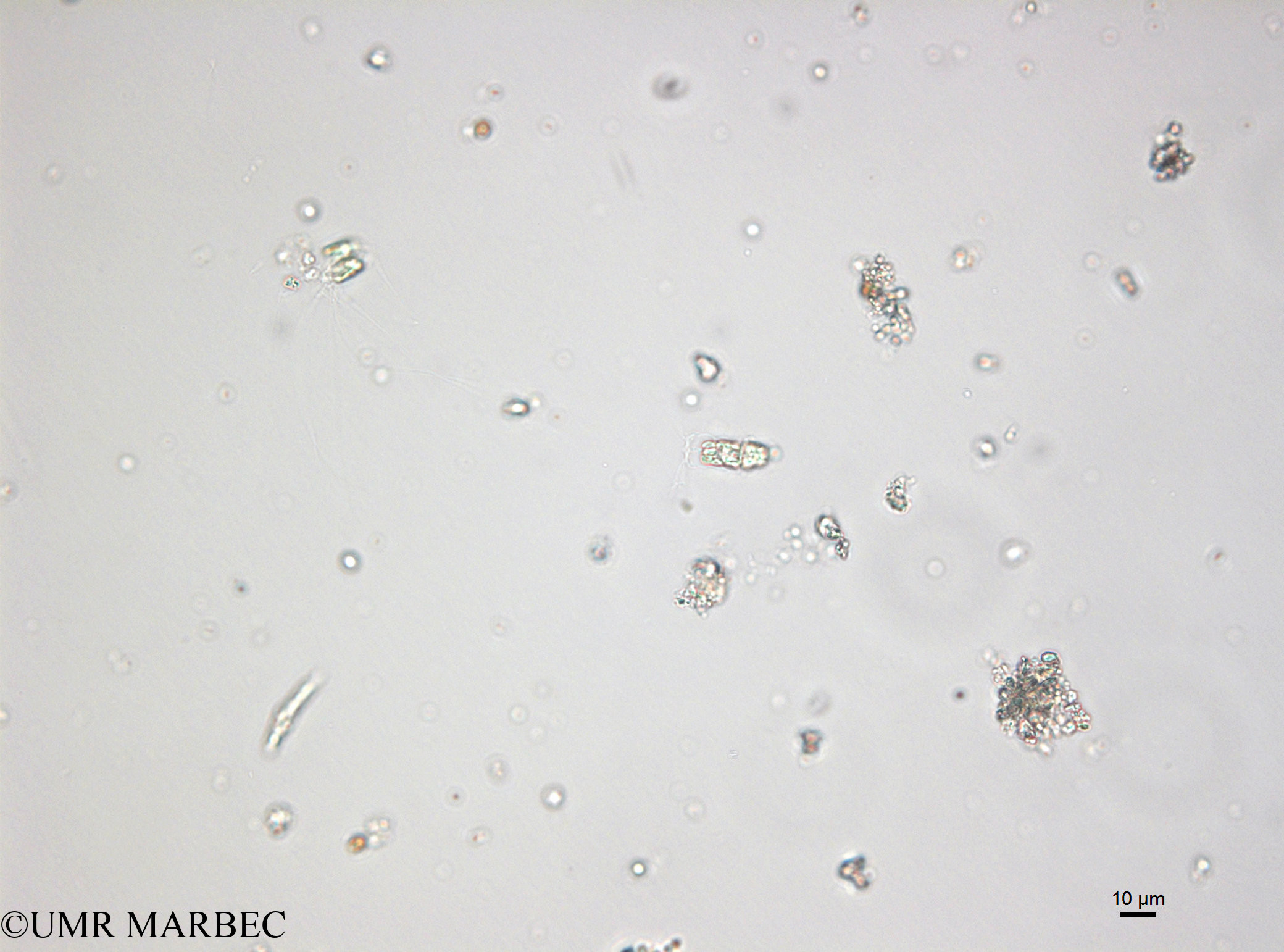 phyto/Bizerte/bizerte_bay/RISCO April 2014/Bacteriastrum sp10 (ancien B. sp4 -150109_001_ovl-6)(copy).jpg